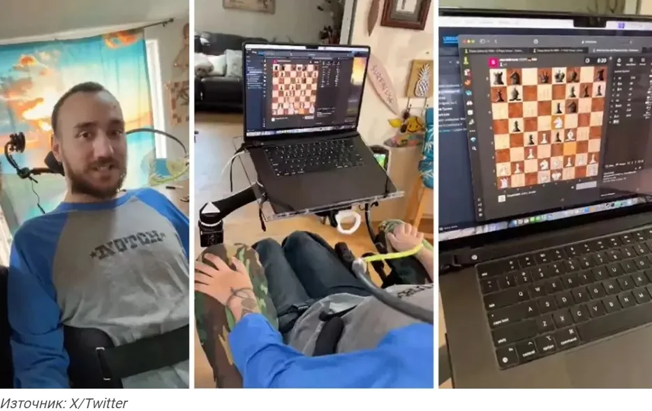 Първият човек с чип на Neuralink в мозъка играе шах онлайн само с мисълта си